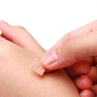 GB 2024-2016 আকুপাংচার প্রেস নিডেল 0.2মিমি X 1.5মিমি চাইনিজ মেডিসিন যন্ত্রপাতির বৈশিষ্ট্য নিরাপত্তা স্ট্যান্ডার্ড